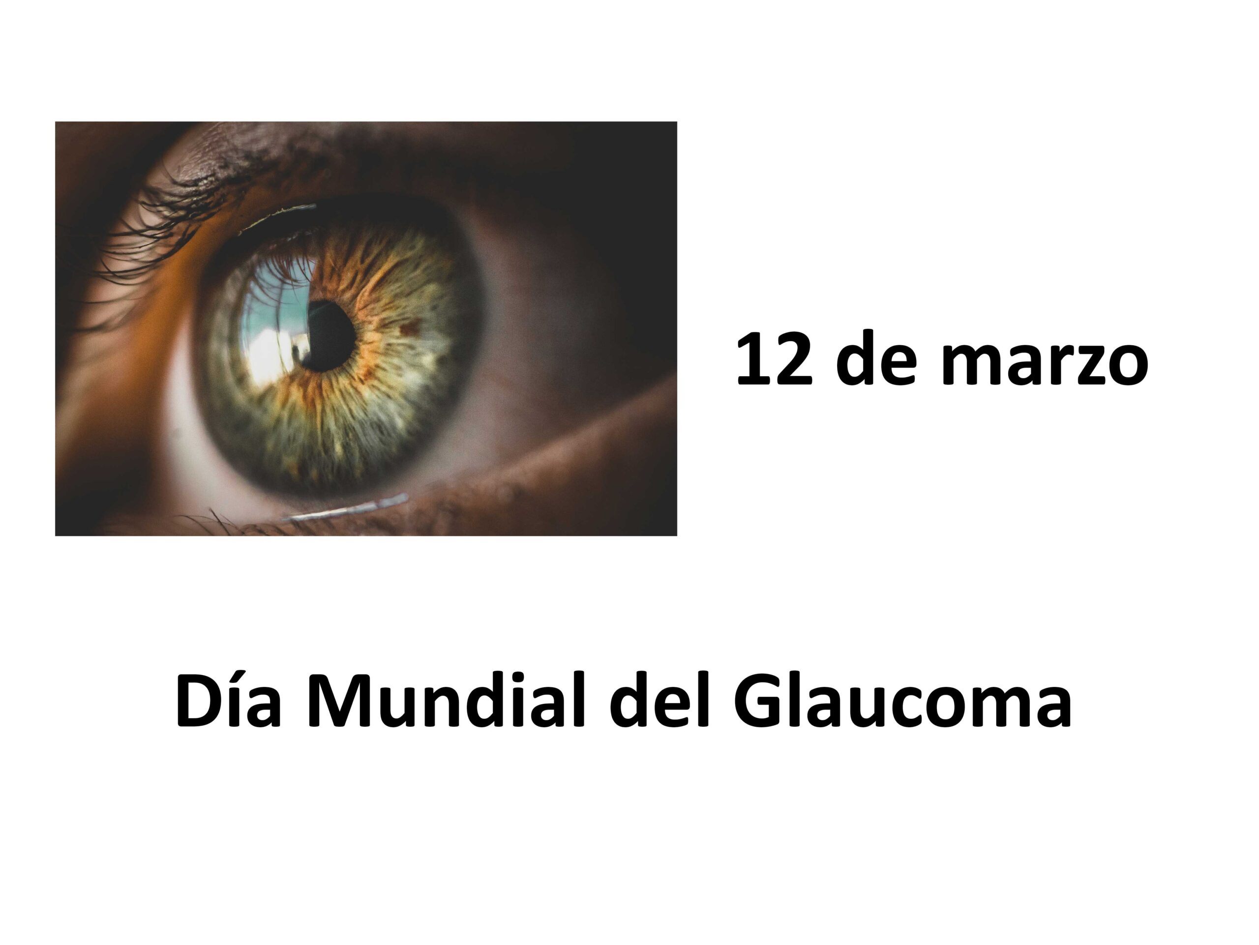 12 De Marzo Día Mundial Del Glaucoma Idissc